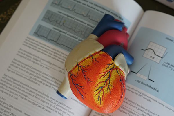 informations pratiques sur le coeur arrêt cardiaque?